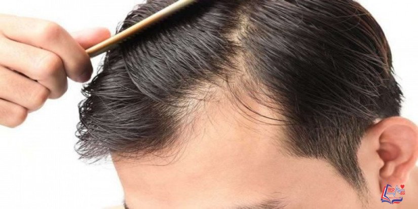 أهم التقنيات المستخدمة في مجال عمليات زراعة الشعر