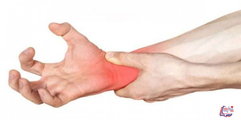 مرض النسيج الضام Connective tissue disease